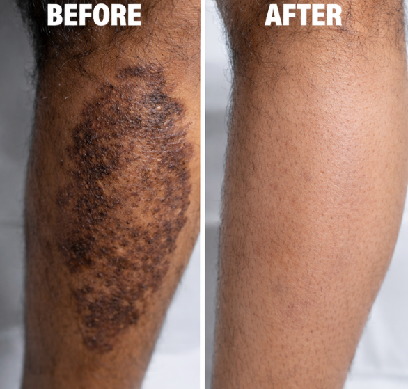skin